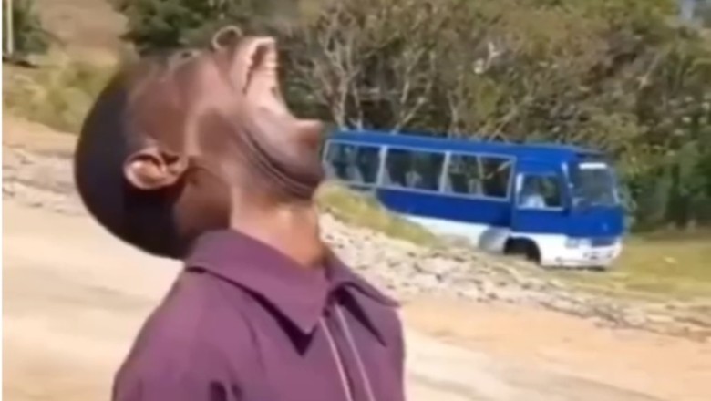 Warning: Laughter Is Contagious! ๐๐ | Hilarious Moments That Could Break Your Funny Bone!